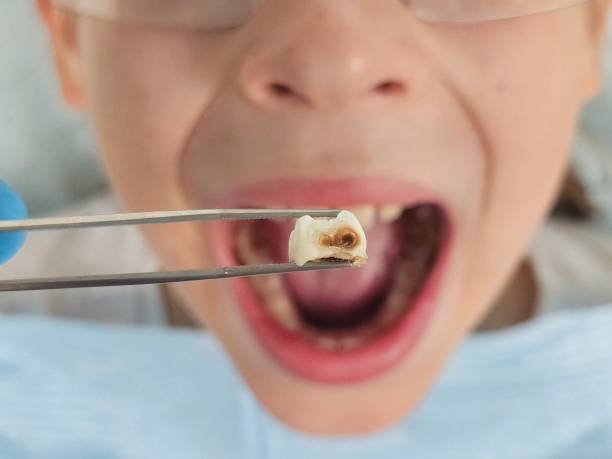 Best Walk-In Emergency Dental Services in Andrews Af, MD